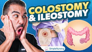 Colostomy and Ileostomy Nursing  Indications Complications Care EASY [upl. by Yhtomit]