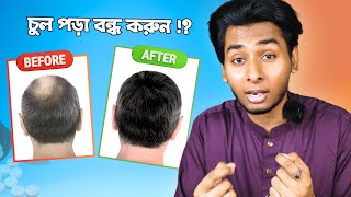 How to stop hair fall and regrow hair  চুল পড়া বন্ধের ঘরোয়া উপায় কি   Summer hair care [upl. by Anadal]