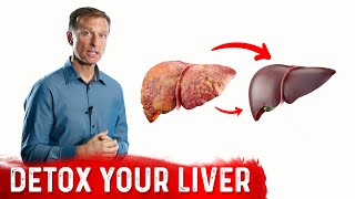 A Surprising Way To Cleanse Fatty Liver – Dr Berg On Liver Detoxification [upl. by Rizika162]