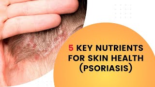 5 Key Nutrients for Skin Health Psoriasis [upl. by Nedyah278]