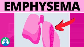 Emphysema Medical Definition  Quick Explainer Video [upl. by Matilda]