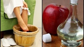 😮😮Dip Your Feet In Vinegar For This AllNatural Benefits [upl. by Anitsirt]