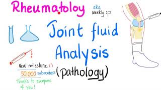 Joint fluid analysis Pathology  Joint Aspiration  Rheumatology [upl. by Esahc977]