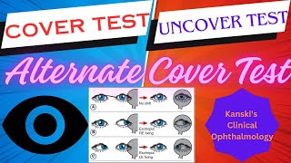 CoverUncover testsKanskis clinical ophthalmology squint tropia phoria [upl. by Farand]