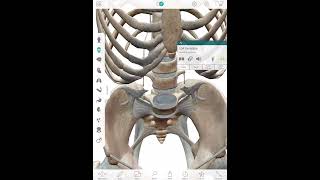 L5S1 Disc Protrusion [upl. by Herates]