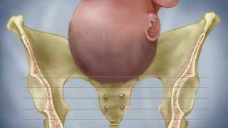 Fetal Descent Birth Station Progress Dilation Effacement Labor Contractions [upl. by Keppel]