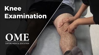 Knee Examination  Orthopaedics [upl. by Nnaillek]