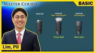 Master Course Season2  BASIC Introducing Implants [upl. by Rao89]