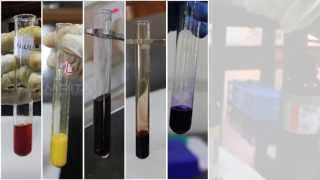 Qualitative Analysis of Amino Acids  Amrita University [upl. by Oirram]