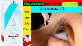 TRAVATAN Ophthalmic Solution Uses in glaucoma and OcularHypertension Side Effects thepharmacistdrx [upl. by Yrneh]