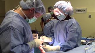 Bunion and Hammertoe Surgery Foot Pain Treatment [upl. by Gernhard]