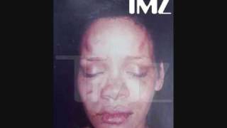 Rihanna Picture after Chris Brown beating provided by TMZ [upl. by Ayrolg]