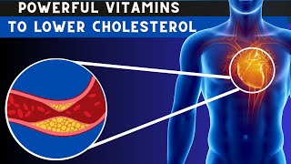 Lower Cholesterol  Top 7 Vitamins To Lower cholesterol Naturally [upl. by Ahsrat]