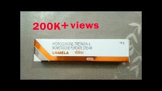 Lomela cream Full Review In Hindi  How to get fairness first without any sideeffect [upl. by Ogu]