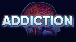 The Science of Addiction and The Brain [upl. by Odnala422]