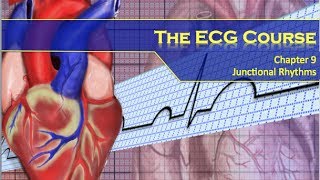 The ECG Course  Junctional Rhythms [upl. by Malcom]