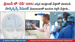 బ్రెయిన్ లో చిప్ DBS ఎక్కడ ఇంప్లాంట్ చేస్తారో చూడండి  మేలుకావాలో ఉండగా సర్జరీ చేస్తారు [upl. by Heinrich658]