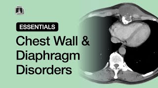 Chest Wall amp Diaphragm Disorders  Chest Radiology Essentials [upl. by Mailand]