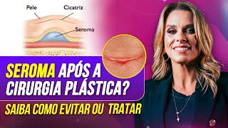 O Que Ninguém Te Conta Sobre Seromas no PósOperatório – Saiba Como Evitar [upl. by Pardoes]