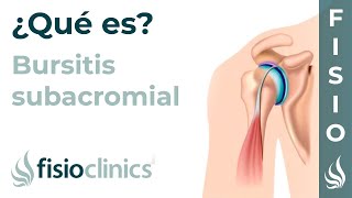 ¿Qué es la bursitis subacromial  FisioClinics Palma de Mallorca [upl. by Nemad556]