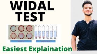 Widal Test in Hindi  Widal Test procedure  Widal Test [upl. by Uaerraj]