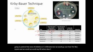 Kirby Bauer Testing for Drug Susceptibility [upl. by Tengdin]