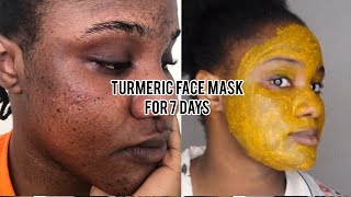 I TRIED THE TURMERIC FACE MASK FOR 7 DAYS REALISTIC RESULTS  SARAH KYOLA [upl. by Guy]