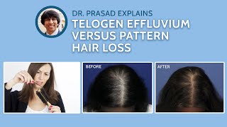 Differences Between Telogen Effluvium and Genetic Pattern Hair Loss [upl. by Arhez918]