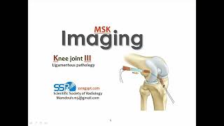 Knee joint imaging ligamentous injuries PT Prof Mamdouh Mahfouz [upl. by Liakim792]