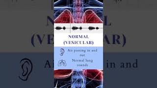 normal lung soundsNormal vesicular breathing viralshorts viralshort youtubeshorts youtubeshort [upl. by Efron]