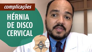 Principais Complicações na Cirurgia de Hérnia de Disco Cervical [upl. by Grantley]