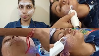 Laser Treatment Of My Face 🧑First Sitting Vlog [upl. by Norit]