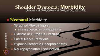 Shoulder Dystocia  Demo [upl. by Ymrots144]