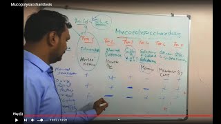 Mucopolysaccharidosis  clinical features of mucopolysaccharidosis  Biochemistry [upl. by Sivie]