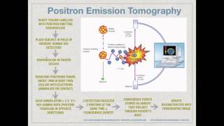 PET and SPECT [upl. by Nnylaf510]