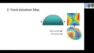 Pentacam overview [upl. by Inajna]