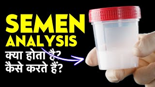 Semen Analysis Test Procedure amp Report in Hindi  Semen Analysis Kaise Hota Hai [upl. by Ihsir]