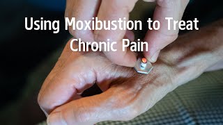 Using moxibustion to treat chronic pain [upl. by Anipsed]