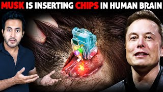 Neuralink HUMAN TRIALS Have Begun ELON MUSK is Inserting Computer Chips Inside HUMAN BRAINS [upl. by Chariot]