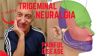 Trigeminal Neuralgia Explained and how I live with it [upl. by Skerl]