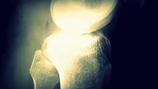 Bone Fracture  XRay Bones  Effect Horror Footage [upl. by Ranzini]