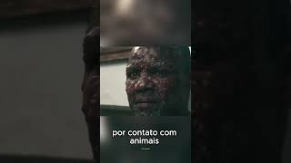 MPOX O Que Realmente Sabemos Sobre a Nova Ameaça Viral sinaisdostempos viralvideo [upl. by Eillek]