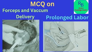 MCQ on Forceps deliveryVacuum delivery and Prolonged Labor RB MCQ Bank Knowledge Booster [upl. by Tull]