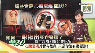 累喘腫竟是「心臟衰竭」症狀？心臟要有力，趕快練握力！健康20 完整版 [upl. by Bond886]