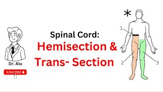 Hemisection amp Transsection of Spinal Cord  Neurology [upl. by Darlene950]