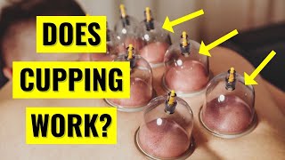 Does Cupping Therapy ACTUALLY Work [upl. by Anelrac370]