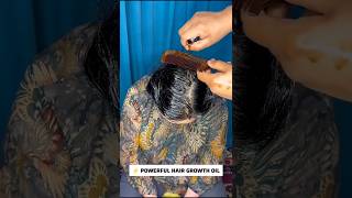 🔥Powerful Hair Growth Oil Long Thick Hair✅ shorts hairgrowth viral RadhaSkincare [upl. by Dimitri]