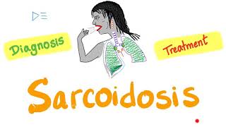 Sarcoidosis Diagnosis and Management  Restrictive Lung Disease  Pulmonology [upl. by Alaehcim]