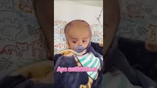 hidrocefalia maedemenino cutebaby diariodematernidade baby viralvideo [upl. by Francine]