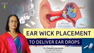 Ear Wick Placement to Deliver Ear Drops  Dr Chandra Jayasuriya EarNoseThroat [upl. by Oidgime]